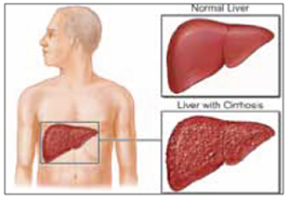 Clinicopathological-Syndromes