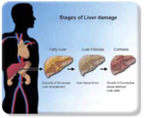 Types-of-Hepatitis